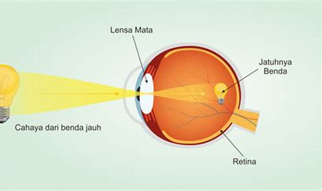 Cara Mengatasi Mata Rabun Jauh Cara Mengatasi Mata Rabun Jauh